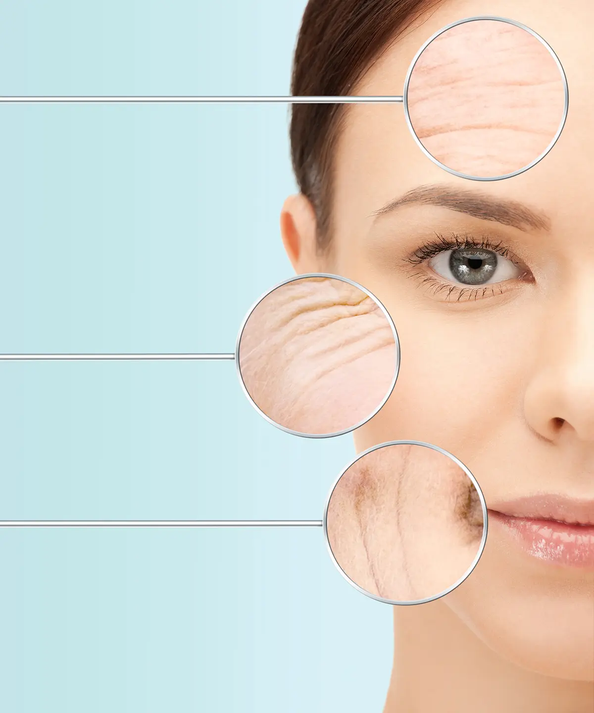 Ameliyatsız Yüz Germe Nedir?