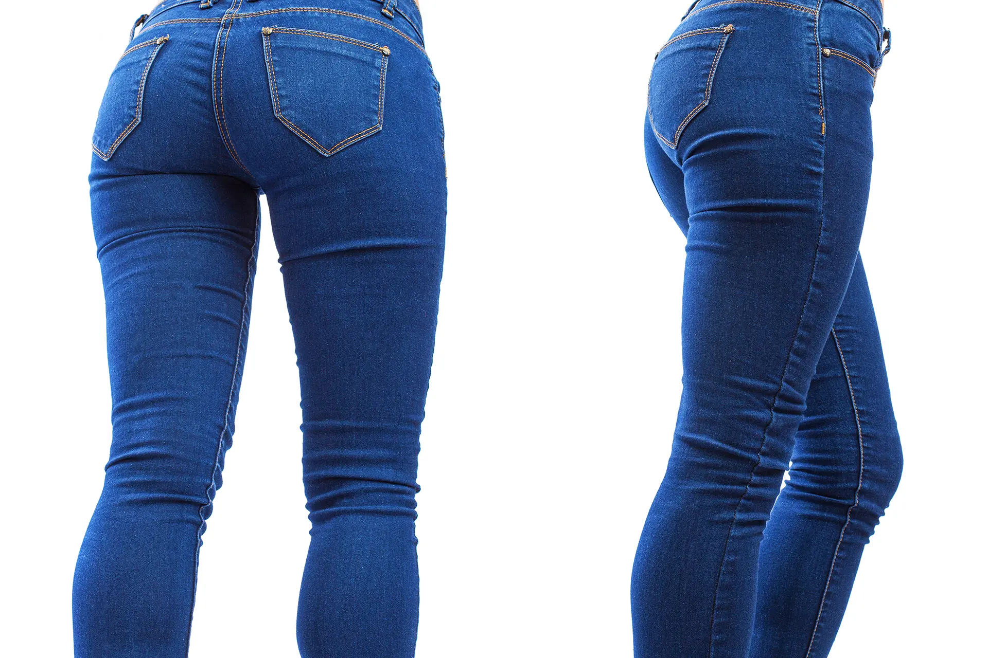 Brezilya Kalçası (BBL)