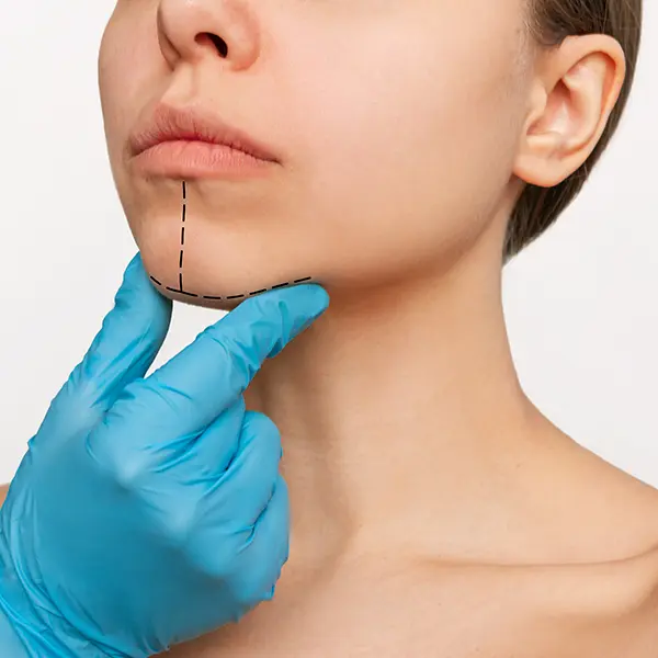 Çene İlerletme ve Geriletme