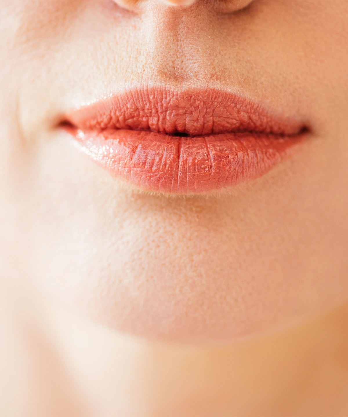 Dudak Estetiği Nasıl Yapılır?