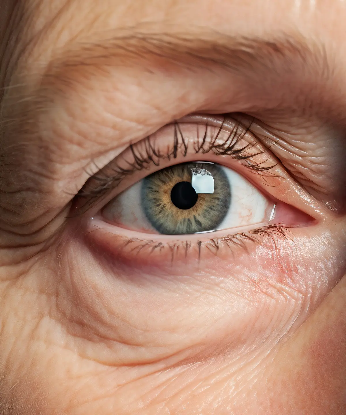 Evde Kırışıklık Tedavisi Yapılır Mı?