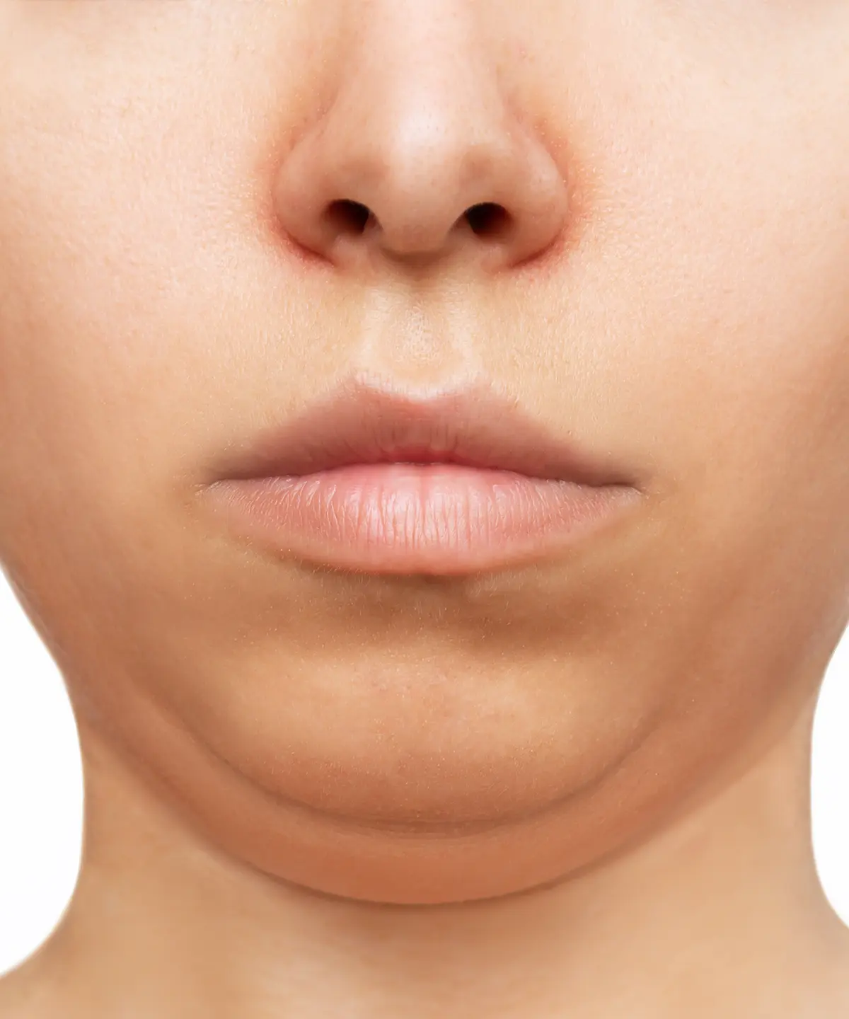 Gıdı Eritme Nedir? Farkı Nedir?