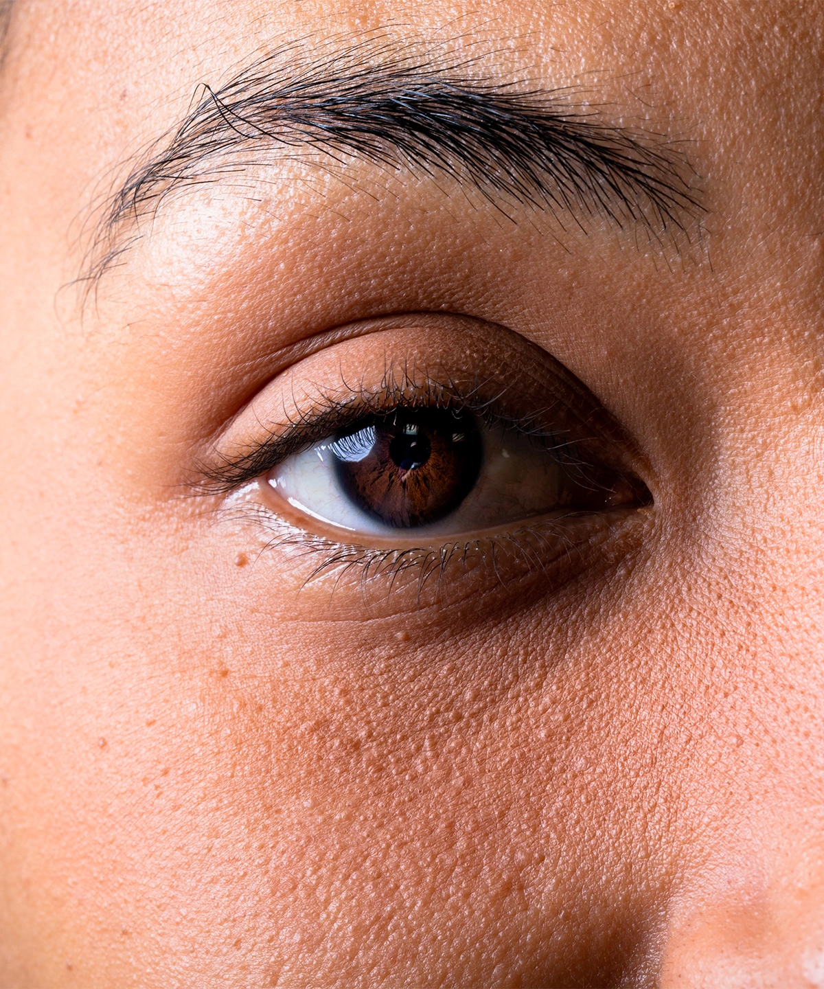 Göz Kapağı Estetiği Nasıl Uygulanır?