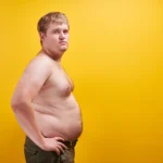 Jinekomasti Nedir ve Nasıl Tedavi Edilir?