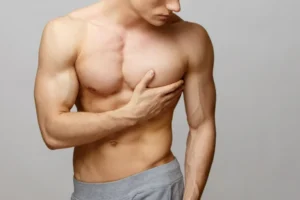 Jinekomasti Nedir?