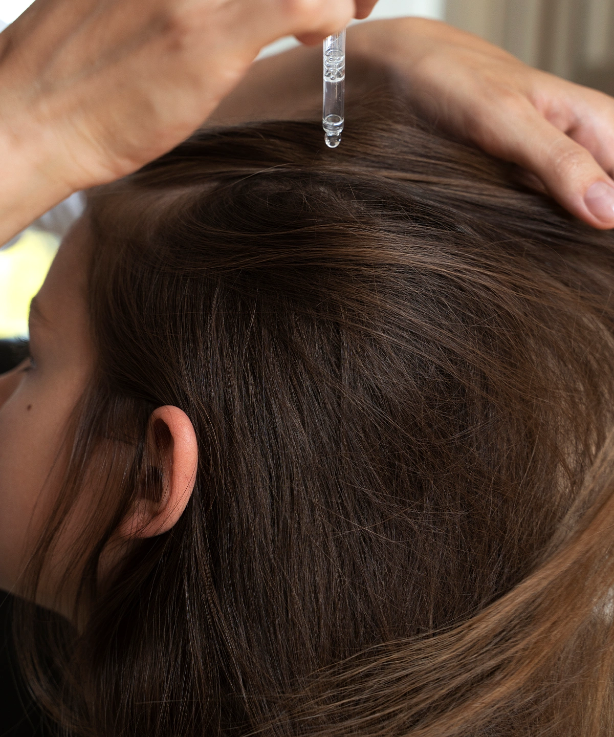 Saç Mezoterapisi Nasıl Yapılır?