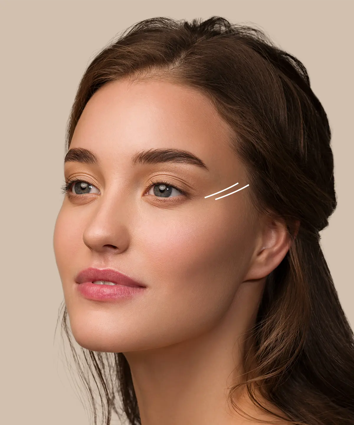 Şakak Estetiği Nasıl Yapılır?