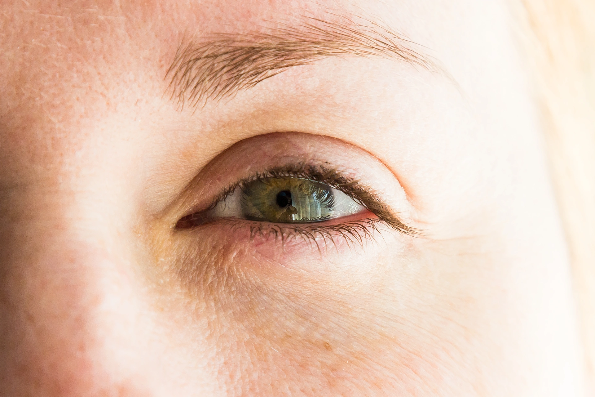 Göz Kapağı Estetiği